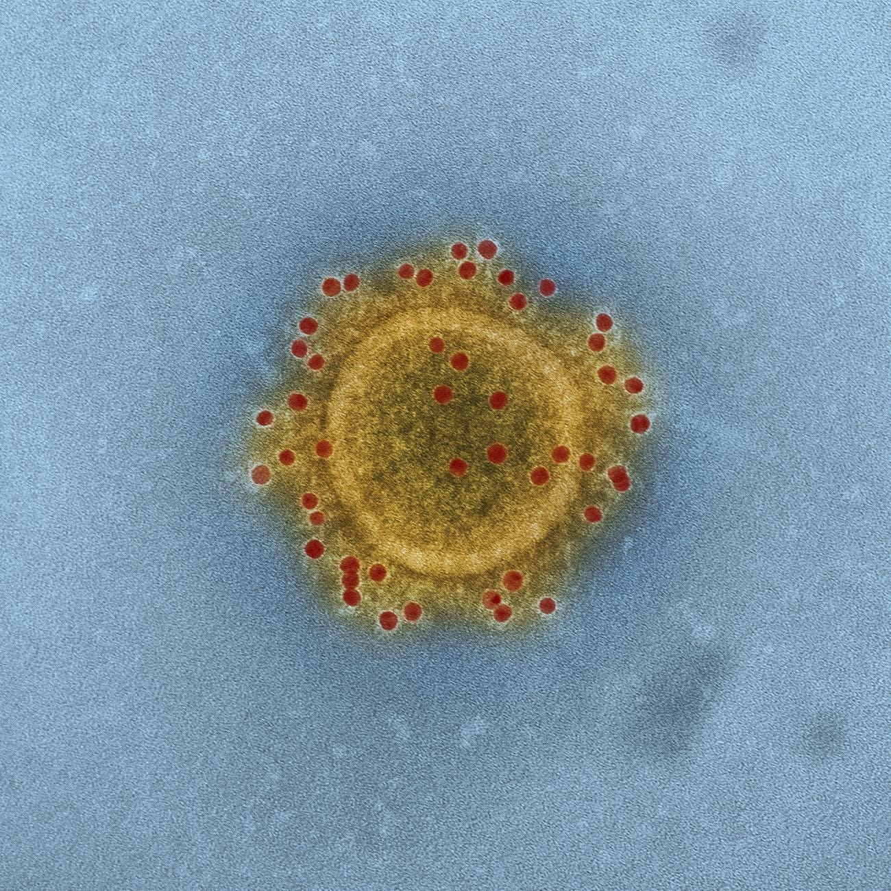 Antibodies